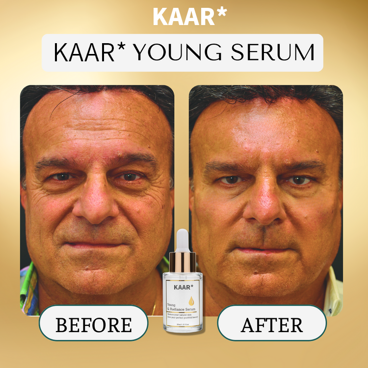 KAAR* Young & Radiance Serum | Gentle & Effective Daily Firming & Skin Tightening for Youthful, Radiant Skin✨️