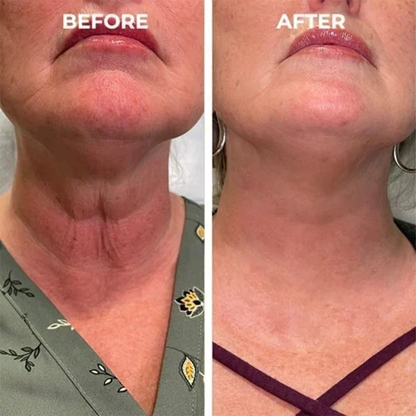 KAAR* Young & Radiance Serum | Gentle & Effective Daily Firming & Skin Tightening for Youthful, Radiant Skin✨️