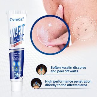 Flash Sale Ending Soon💥Cvreoz® Fast Active Wart Removal Ointment | Skin Tag & Wart Cream