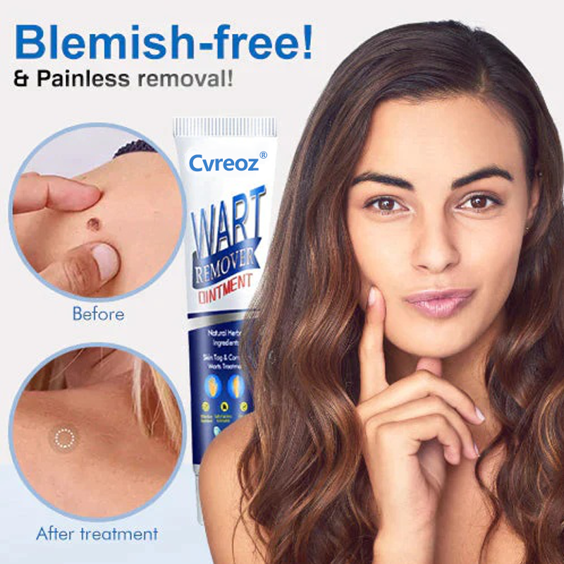 Flash Sale Ending Soon💥Cvreoz® Fast Active Wart Removal Ointment | Skin Tag & Wart Cream