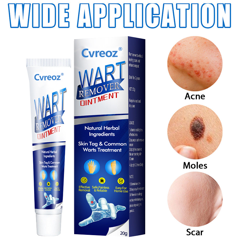Flash Sale Ending Soon💥Cvreoz® Fast Active Wart Removal Ointment | Skin Tag & Wart Cream