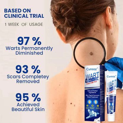 Flash Sale Ending Soon💥Cvreoz® Fast Active Wart Removal Ointment | Skin Tag & Wart Cream