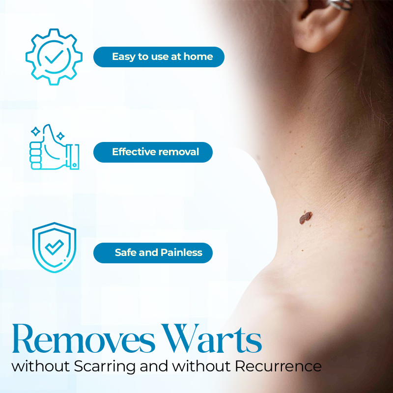 Flash Sale Ending Soon💥Cvreoz® Fast Active Wart Removal Ointment | Skin Tag & Wart Cream