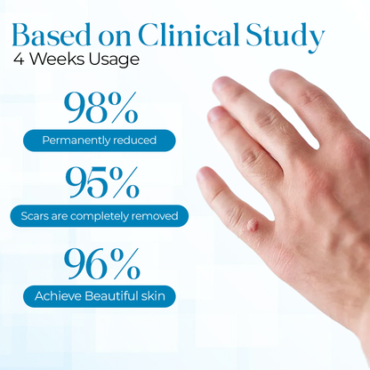 Flash Sale Ending Soon💥Cvreoz® Fast Active Wart Removal Ointment | Skin Tag & Wart Cream