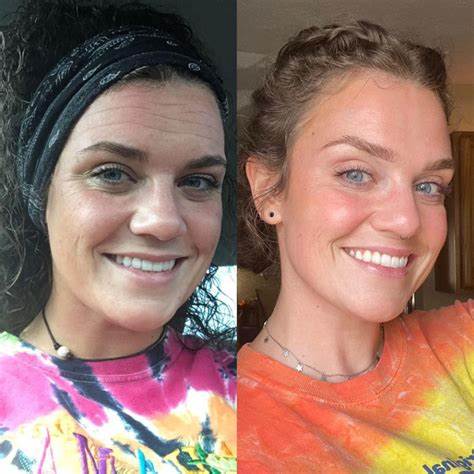 Final Hours—Sale Ending Soon!💥KAAR* Renewal Skin Cream | Spot Removal & Skin Renewal for Dark Spots, Age Spots, and Sun Spots* Daily Firming for All Skin Types
